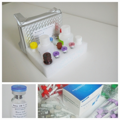 Kit di prova Elisa TB-IGRA sensibile ed accurato per il rilevamento preciso di biomarcatori