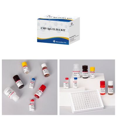 96T CMV ELISA Test Kit con rilevazione colorimetrica e metodo sandwich per anticorpi contro il citomegalovirus
