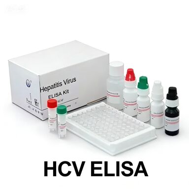 Anti-HCV anticorpi contro il virus dell' epatite C Tempo di trasporto legato all' enzima breve