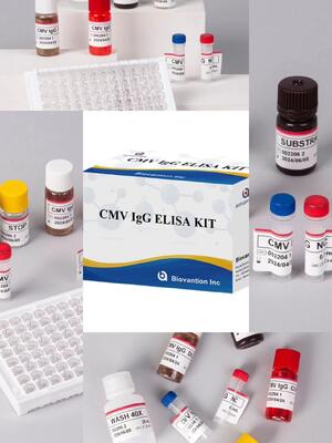 Laboratorio o ospedale Kit di prova CMV IgG Elisa ad alta precisione
