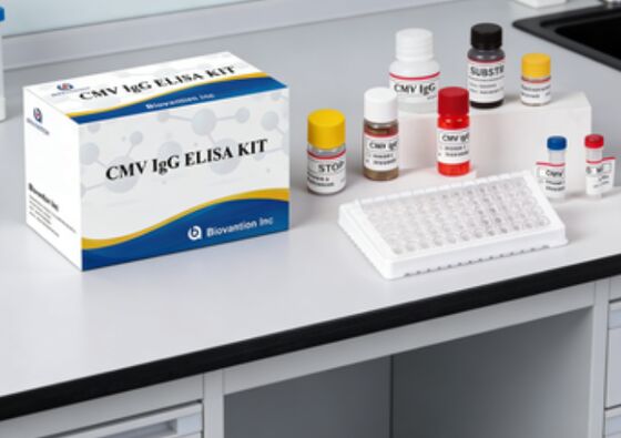 Laboratorio o ospedale Kit di prova CMV IgG Elisa ad alta precisione